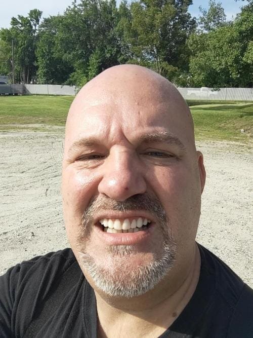 Snap On False Teeth Upper + Lower Dental Instant Veneers Dentures Tooth Cover White | Natural Look photo review