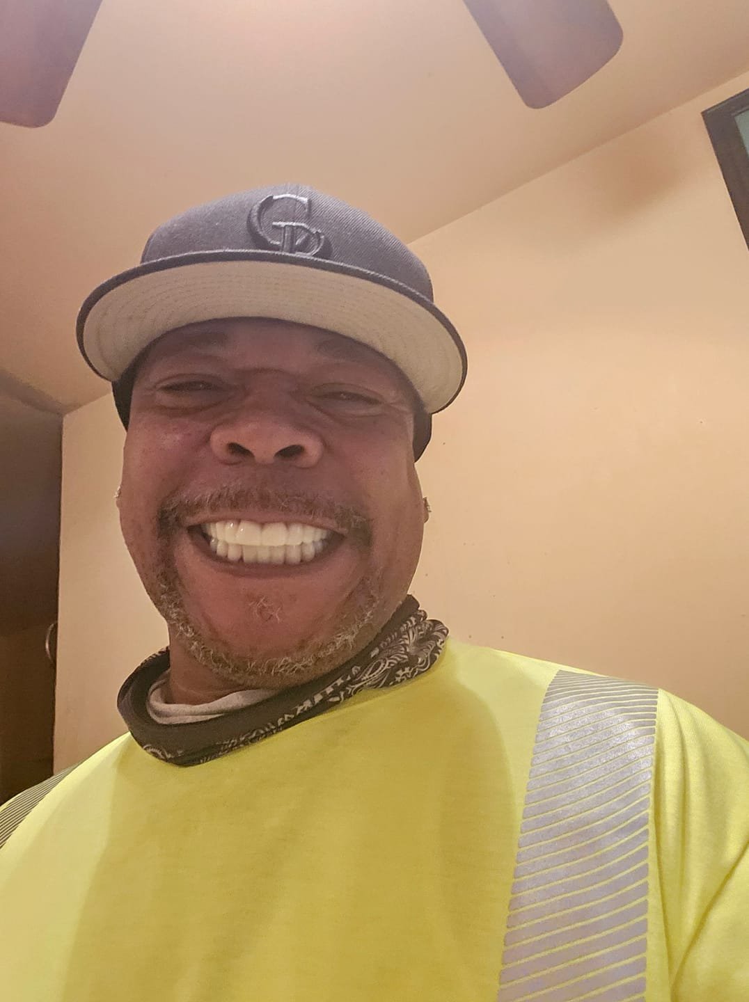 Snap On False Teeth Upper + Lower Dental Instant Veneers Dentures Tooth Cover White | Natural Look photo review