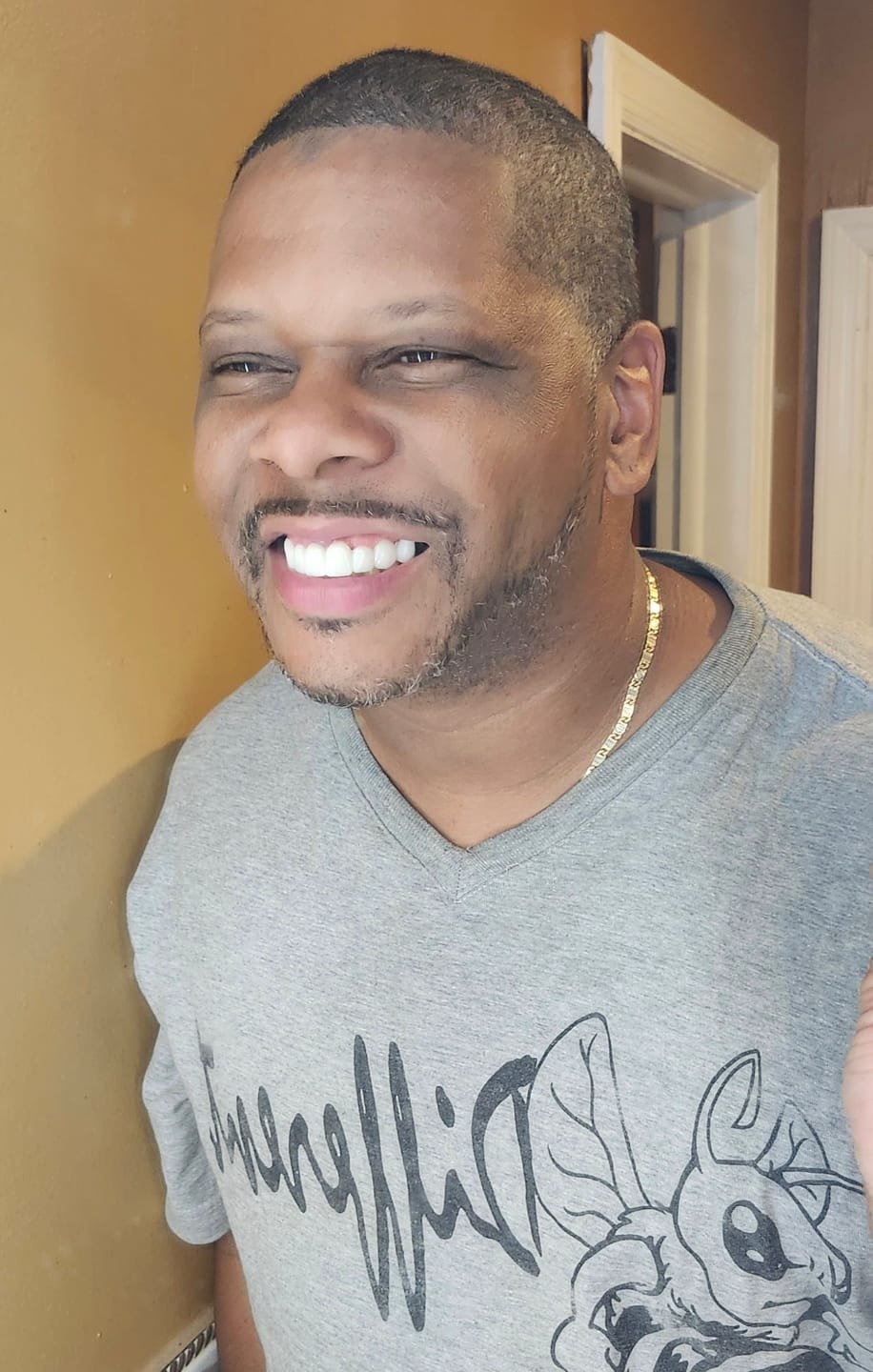 Snap On False Teeth Upper + Lower Dental Instant Veneers Dentures Tooth Cover White | Natural Look photo review