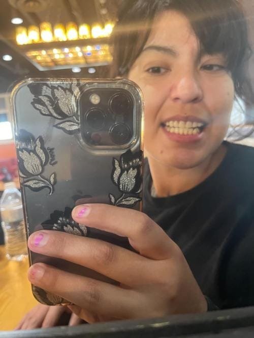 Snap On False Teeth Upper + Lower Dental Instant Veneers Dentures Tooth Cover White | Natural Look photo review