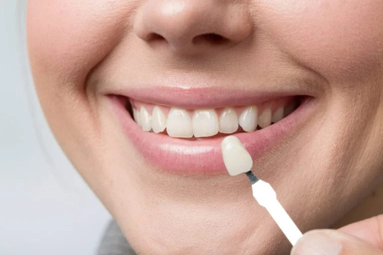 How to Clean and Maintain Your Snap-On Veneers for Long-Term