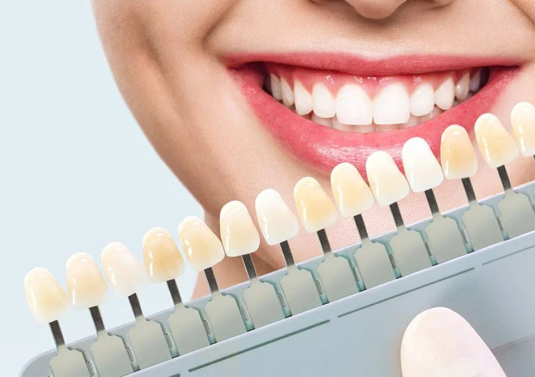 Are Snap-On Veneers Safe for Your Teeth? What Dentists Say