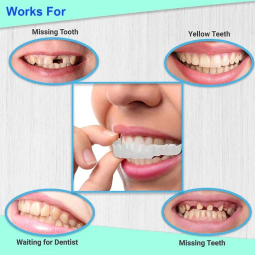 StoreTom Unisex Snap-On Veneers | Natural Look | Instant Smile | BPA-Free| 1 pair (Uper and lower)