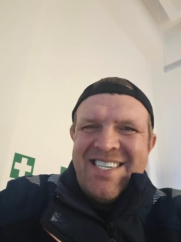 StoreTom Unisex Snap-On Veneers  | Natural Look | Instant Smile | BPA-Free| 1 pair (Uper and lower) photo review